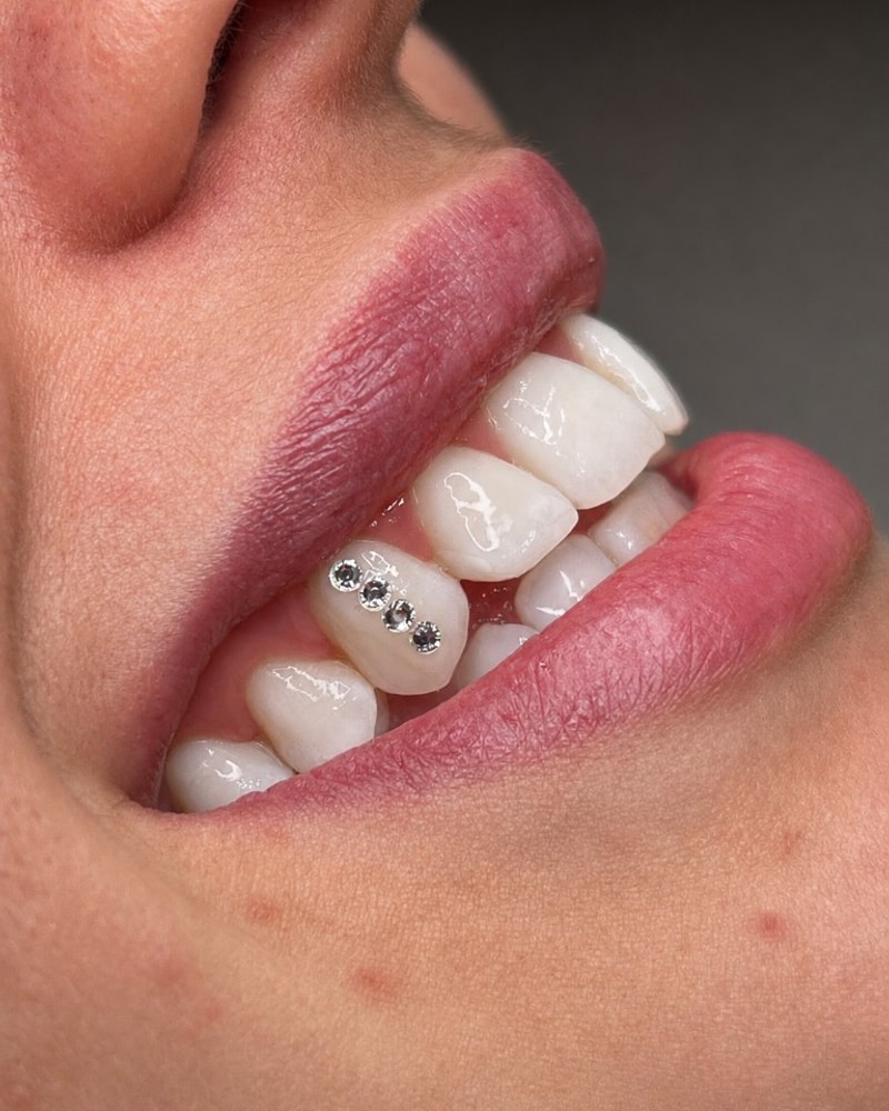 Somriure amb tooth gems — gemes dentals Swarovski