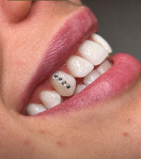 Tooth gems — The Black Cat Tattoo